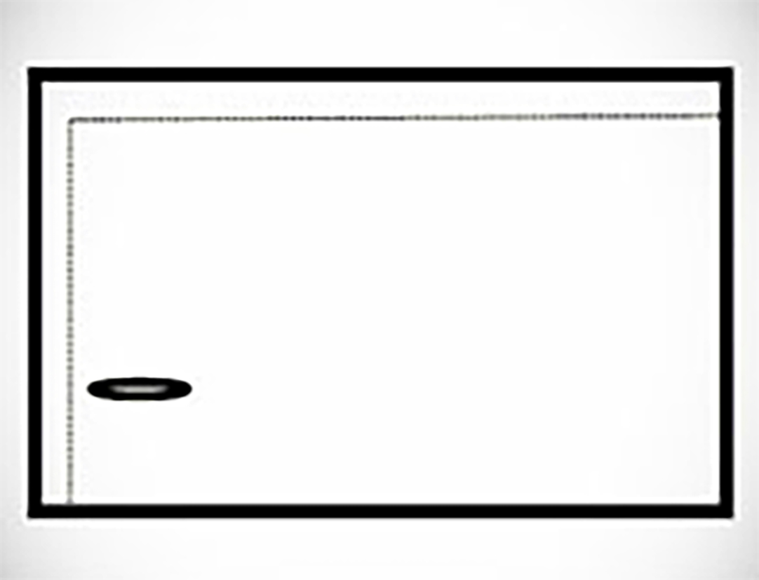 Classic French Square